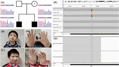 Case Report: Low-Level Maternal Mosaicism of a Novel CREBBP Variant Causes Recurrent Rubinstein-Taybi Syndrome in Two Siblings of a Chinese Family